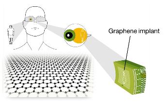 BIOTECHNOLOGIES: GRAPHENE REVOLUTIONIZES NEURAL IMPLANTS